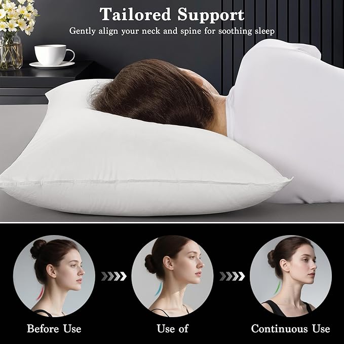 Shilucheng Goose Down Pillow Queen Size Set of 2 Pack,900+ Fill Power Luxury Hotel Quality Bed Feather Pillow for Side Back Stomach Sleepers, Soft 100% Cotton Shell（White,20" x 30"） FX